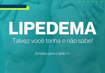 Lipedema - talvez você tenha e não sabe!