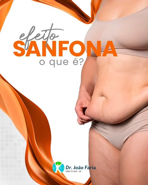Efeito sanfona p que é?