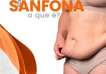 Efeito sanfona p que é?